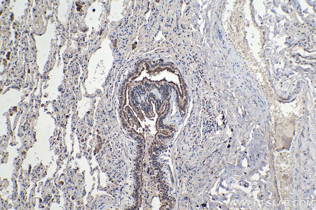 IHC staining of human lung using 12928-1-AP