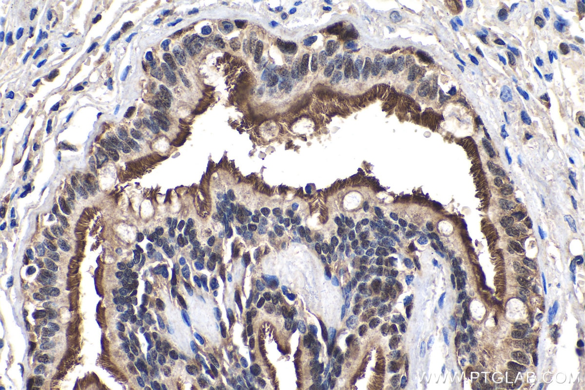 Immunohistochemistry (IHC) staining of human lung tissue using IRF6 Polyclonal antibody (12928-1-AP)