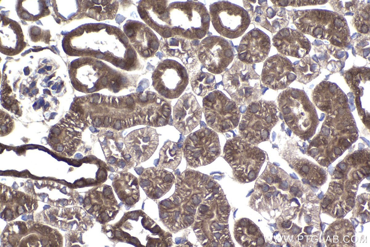 Immunohistochemistry (IHC) staining of mouse kidney tissue using IRF6 Polyclonal antibody (12928-1-AP)