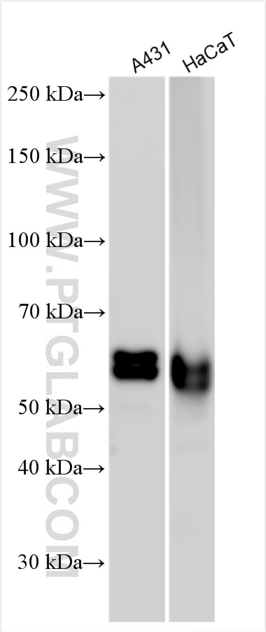Western Blot (WB) analysis of various lysates using IRF6 Polyclonal antibody (12928-1-AP)