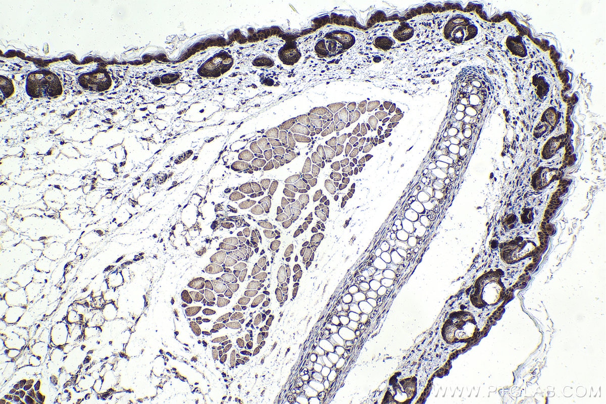 Immunohistochemistry (IHC) staining of mouse skin tissue using IRF7 Polyclonal antibody (22392-1-AP)