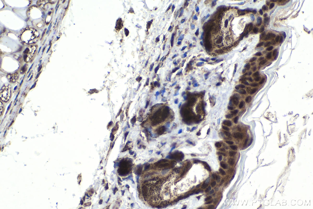 Immunohistochemistry (IHC) staining of mouse skin tissue using IRF7 Polyclonal antibody (22392-1-AP)