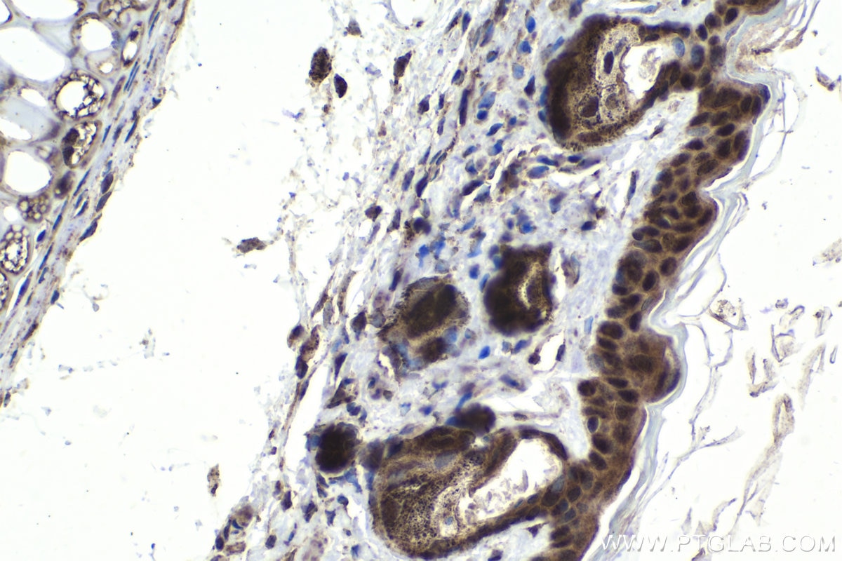 IHC staining of mouse skin using 22392-1-AP