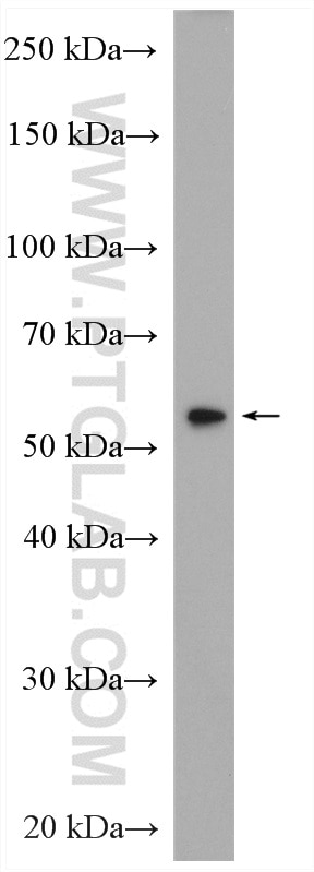 Western Blot (WB) analysis of HEK-293 cells using IRF7 Polyclonal antibody (22392-1-AP)