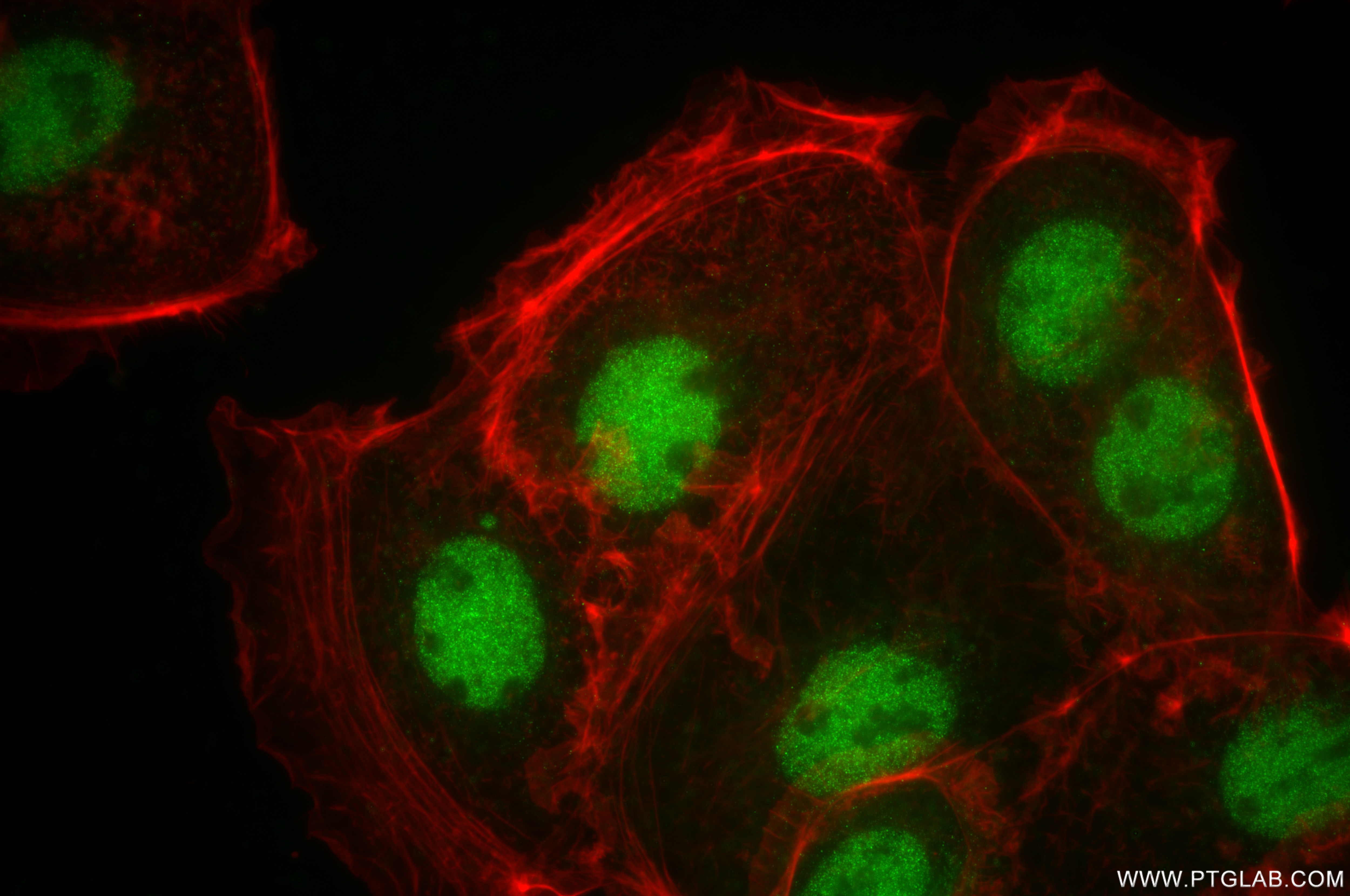 Immunofluorescence (IF) / fluorescent staining of Caco-2 cells using IRF7 Recombinant monoclonal antibody (85072-5-RR)