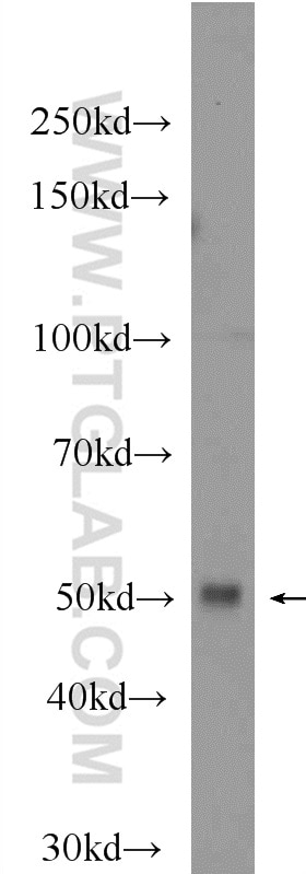 Western Blot (WB) analysis of Raji cells using IRF8 Polyclonal antibody (24437-1-AP)