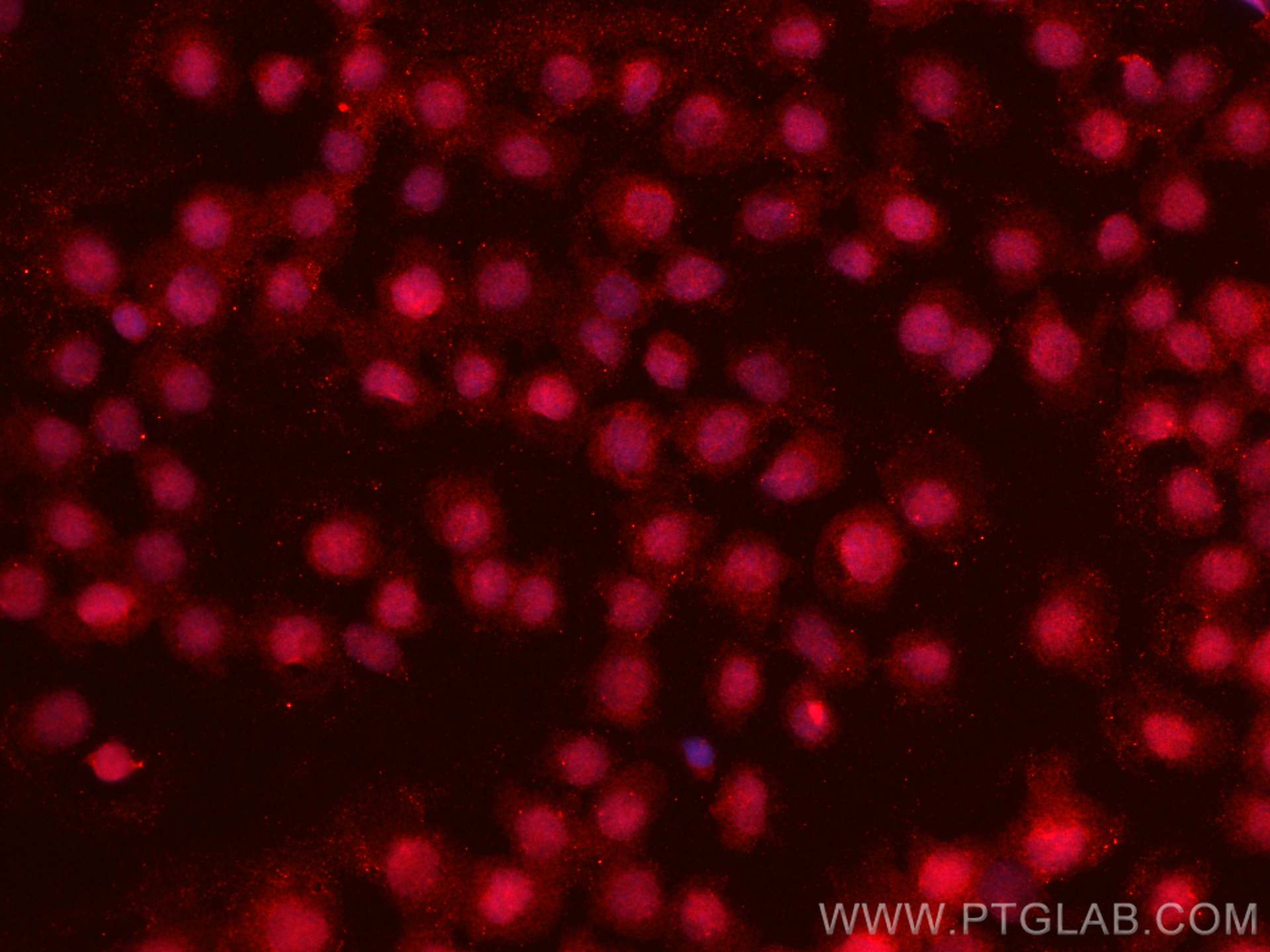 Immunofluorescence (IF) / fluorescent staining of THP-1 cells using CoraLite® Plus 594-conjugated IRF8 Monoclonal anti (CL594-67142)