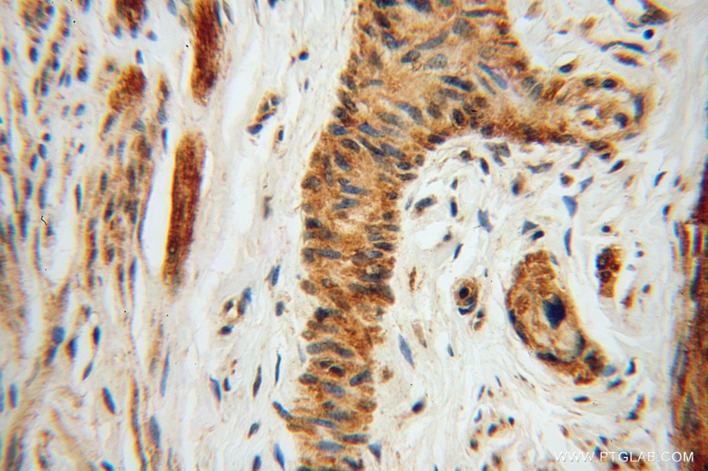 IRF9 Polyclonal antibody