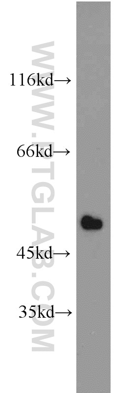 Western Blot (WB) analysis of mouse heart tissue using IRF9 Polyclonal antibody (14167-1-AP)