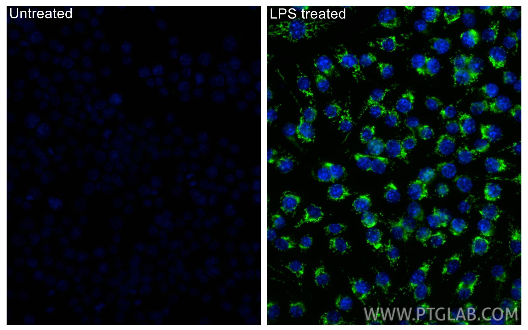 IF Staining of RAW 264.7 using 86725-1-RR Immunofluorescence (IF) / fluorescent staining of RAW 264.7 cells using IRG1 Recombinant monoclonal antibody (86725-1-RR)