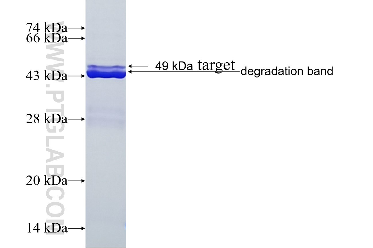 IRG1 fusion protein Ag28913 SDS-PAGE