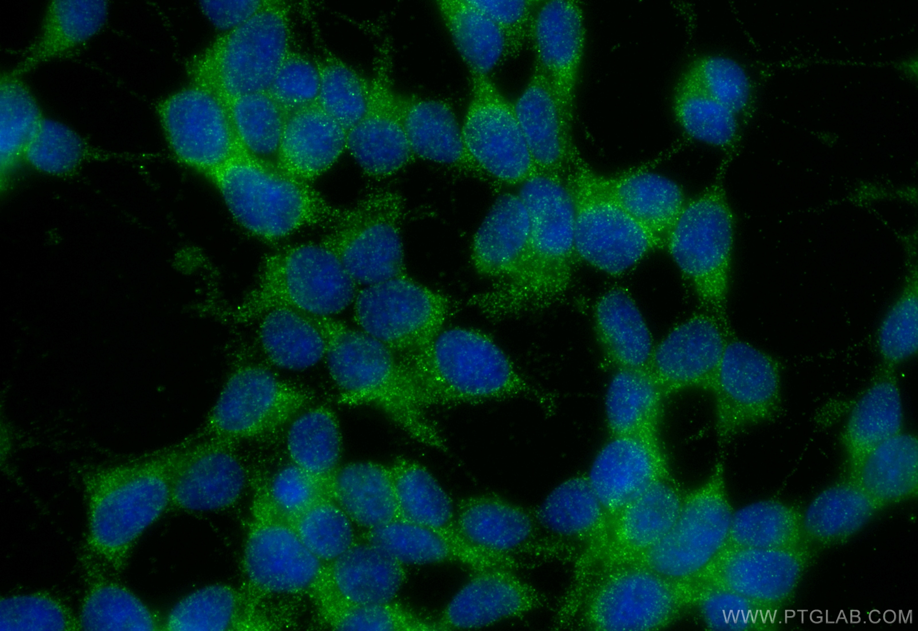 Immunofluorescence (IF) / fluorescent staining of SH-SY5Y cells using IRGC Polyclonal antibody (14090-1-AP)