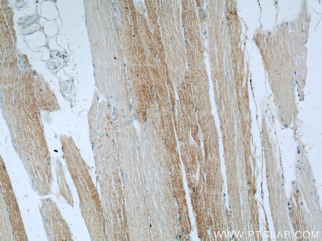 Immunohistochemistry (IHC) staining of human skeletal muscle tissue using IRGQ Polyclonal antibody (23239-1-AP)