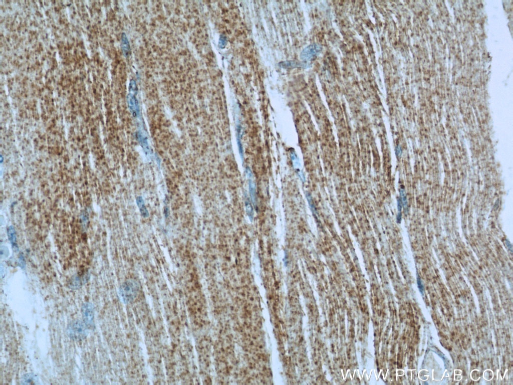 Immunohistochemistry (IHC) staining of human skeletal muscle tissue using IRGQ Polyclonal antibody (23239-1-AP)