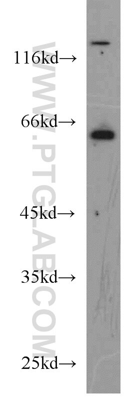 Western Blot (WB) analysis of MCF-7 cells using IRGQ Polyclonal antibody (23239-1-AP)