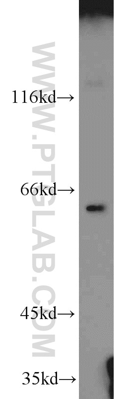Western Blot (WB) analysis of A2780 cells using IRGQ Polyclonal antibody (23239-1-AP)