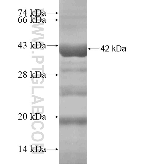IRGQ fusion protein Ag19607 SDS-PAGE