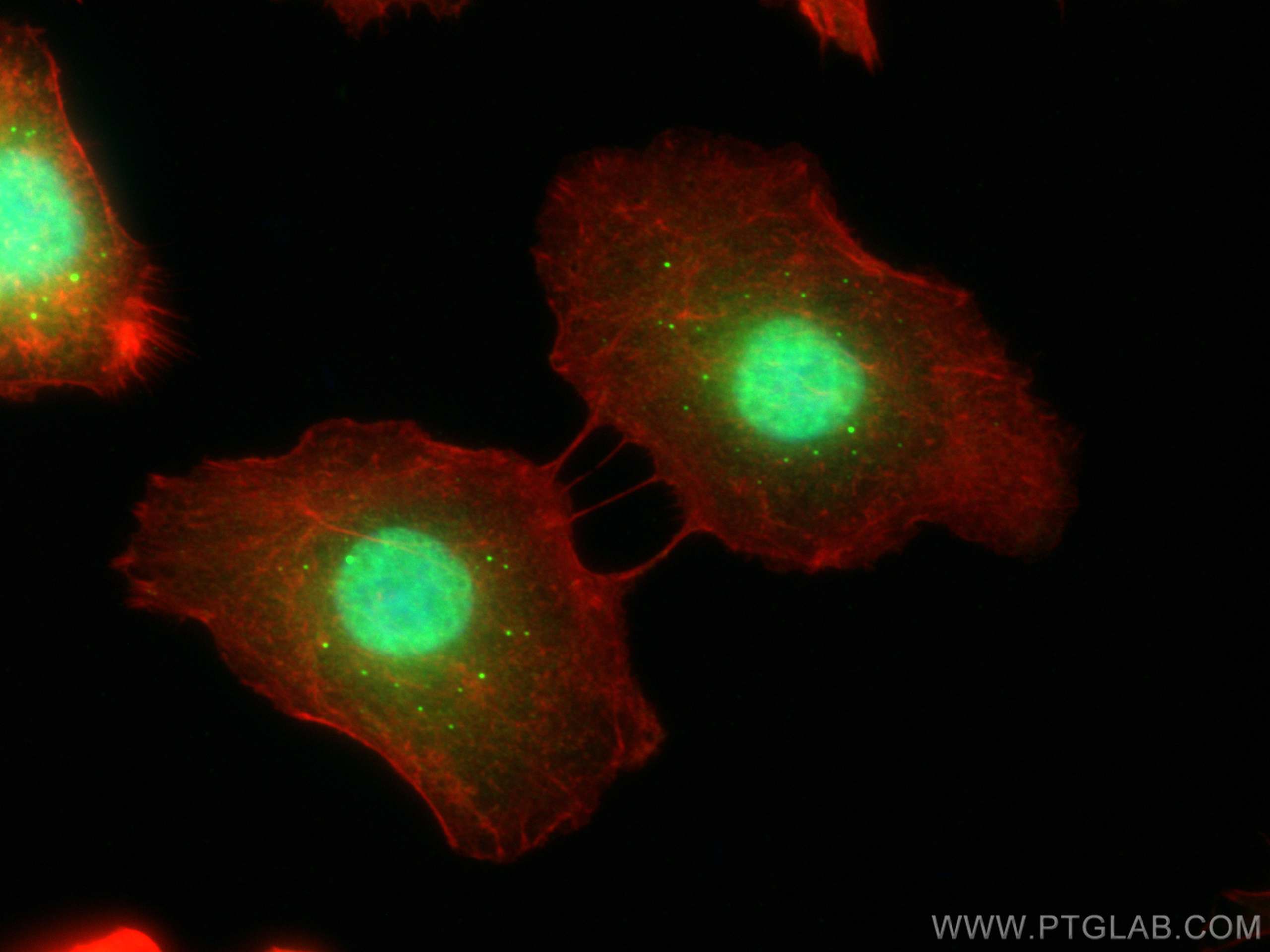 IF Staining of A549 using 17509-1-AP