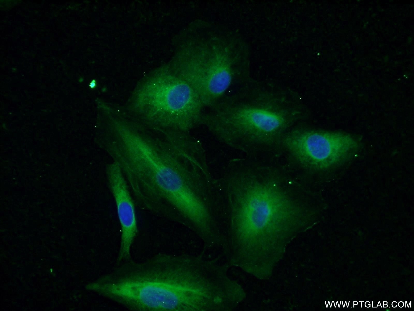 IRS1 Polyclonal antibody