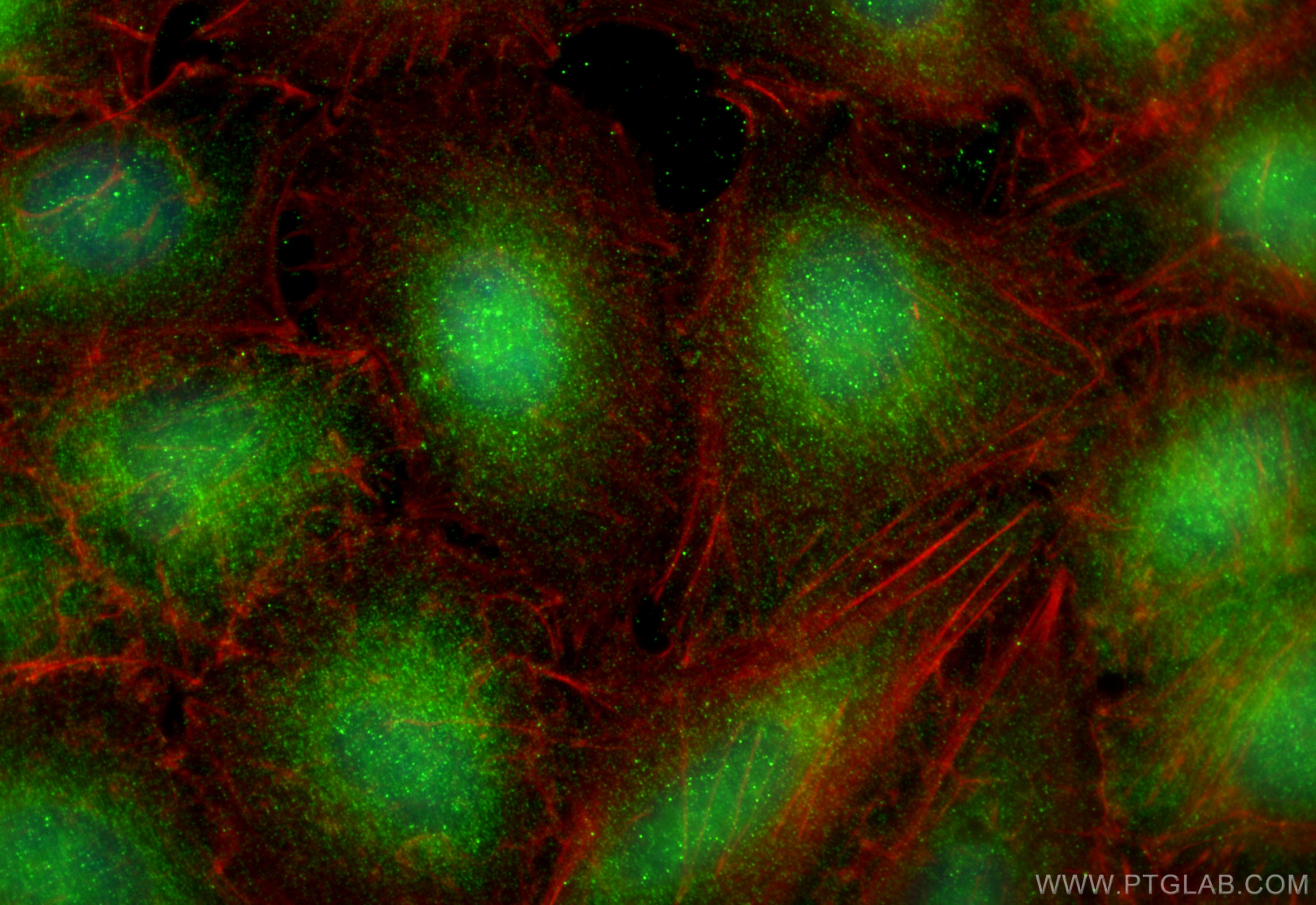 Immunofluorescence (IF) / fluorescent staining of A549 cells using IRS1 Polyclonal antibody (17509-1-AP)