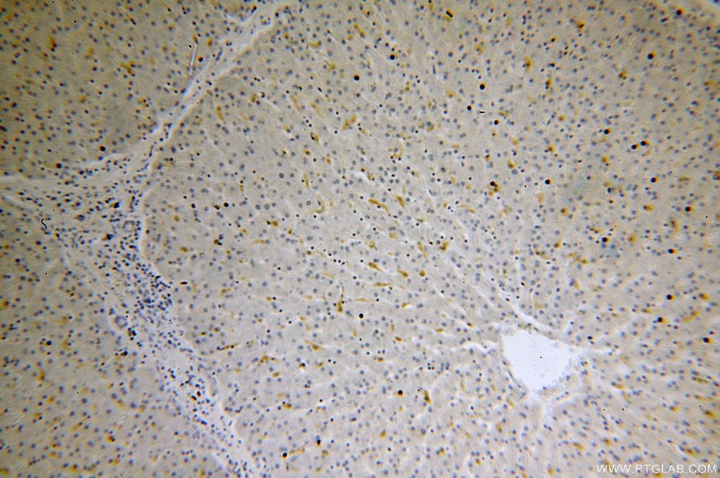 Immunohistochemistry (IHC) staining of human liver tissue using IRS1 Polyclonal antibody (17509-1-AP)