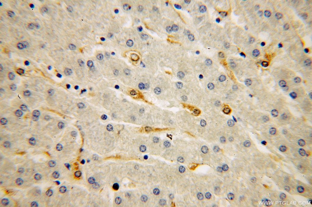 Immunohistochemistry (IHC) staining of human liver tissue using IRS1 Polyclonal antibody (17509-1-AP)