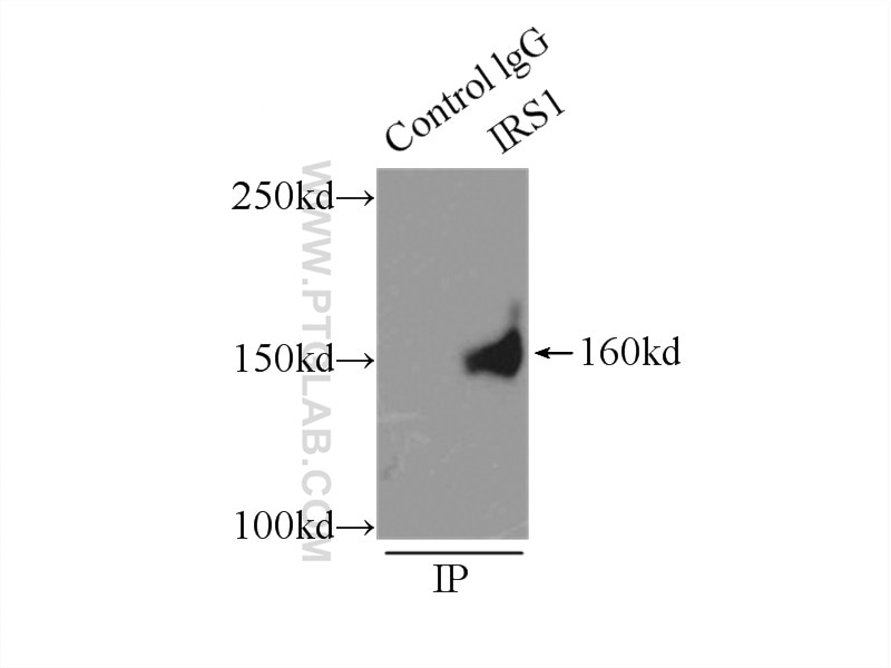 Immunoprecipitation (IP) experiment of A549 cells using IRS1 Polyclonal antibody (17509-1-AP)