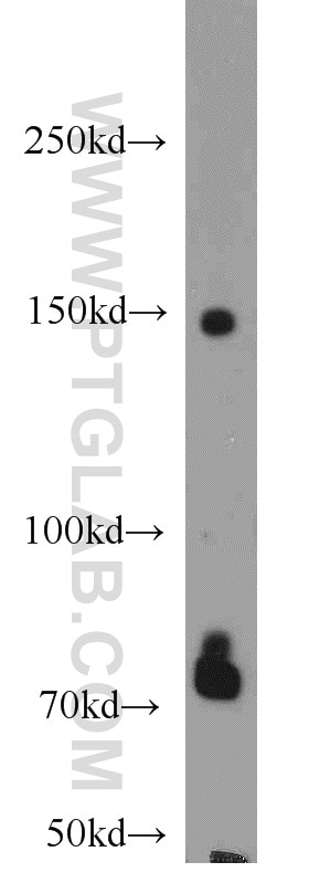 Western Blot (WB) analysis of PC-3 cells using IRS1 Polyclonal antibody (17509-1-AP)