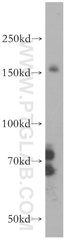 Western Blot (WB) analysis of HEK-293 cells using IRS1 Polyclonal antibody (17509-1-AP)