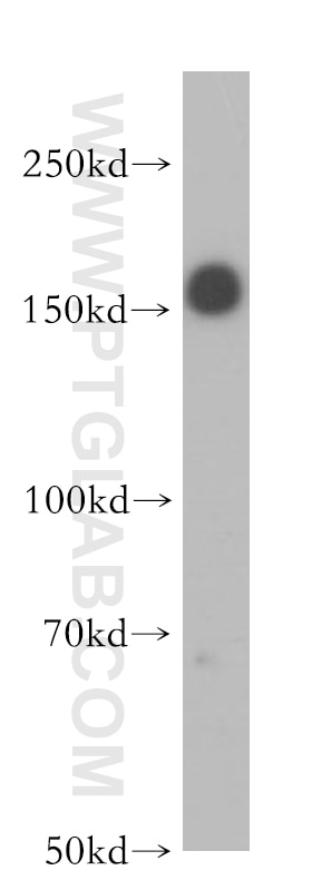 Western Blot (WB) analysis of A549 cells using IRS1 Polyclonal antibody (17509-1-AP)