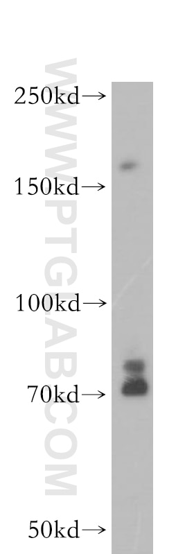 Western Blot (WB) analysis of A431 cells using IRS1 Polyclonal antibody (17509-1-AP)