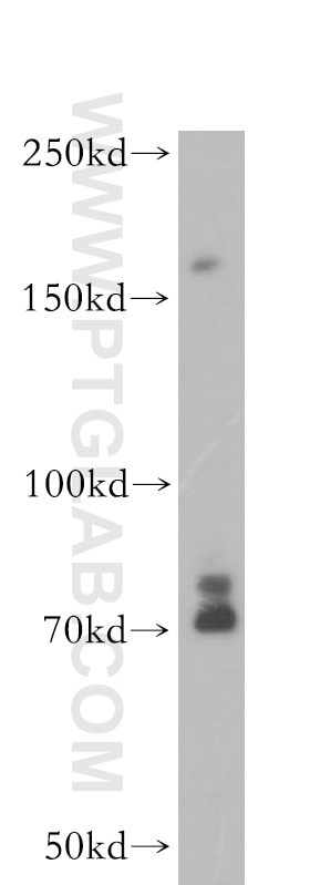 WB analysis of A431 using 17509-1-AP