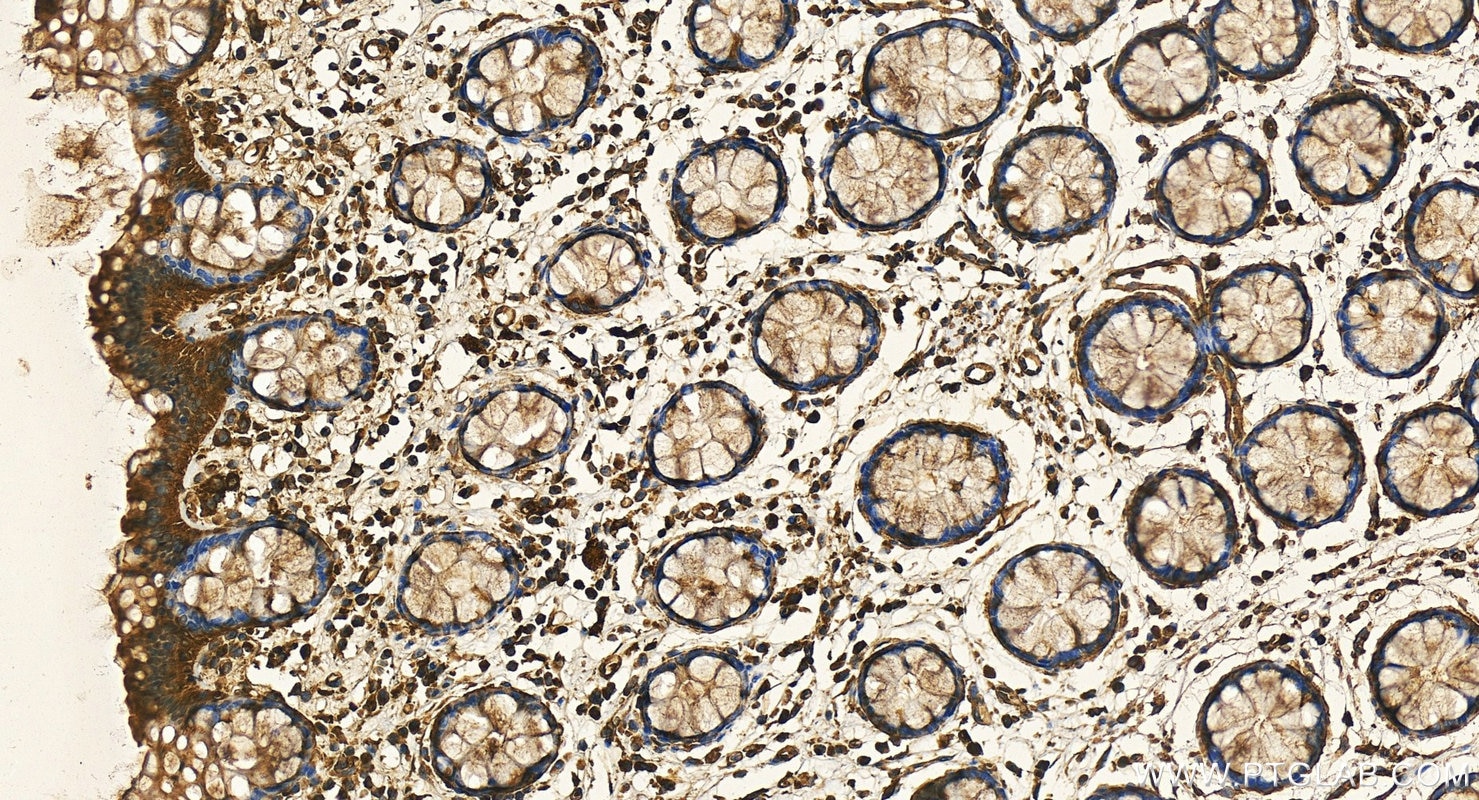 Immunohistochemistry (IHC) staining of human colon tissue using IRS1 Recombinant antibody (82730-10-RR)