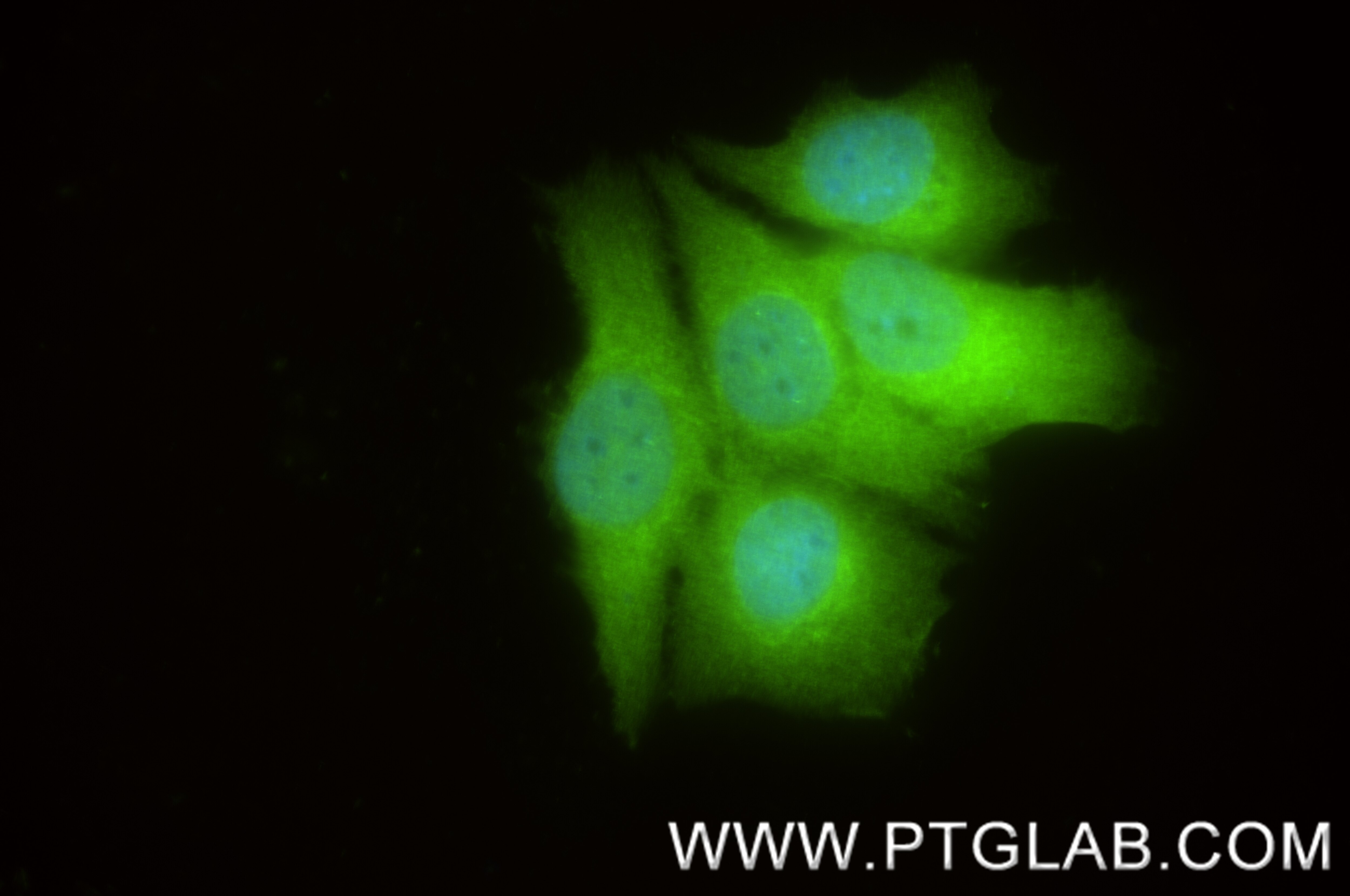 Immunofluorescence (IF) / fluorescent staining of MCF-7 cells using IRS1 Recombinant antibody (82730-10-RR)