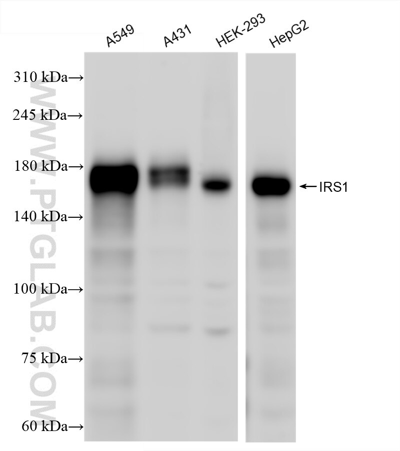 Western Blot (WB) analysis of various lysates using IRS1 Recombinant antibody (82730-10-RR)