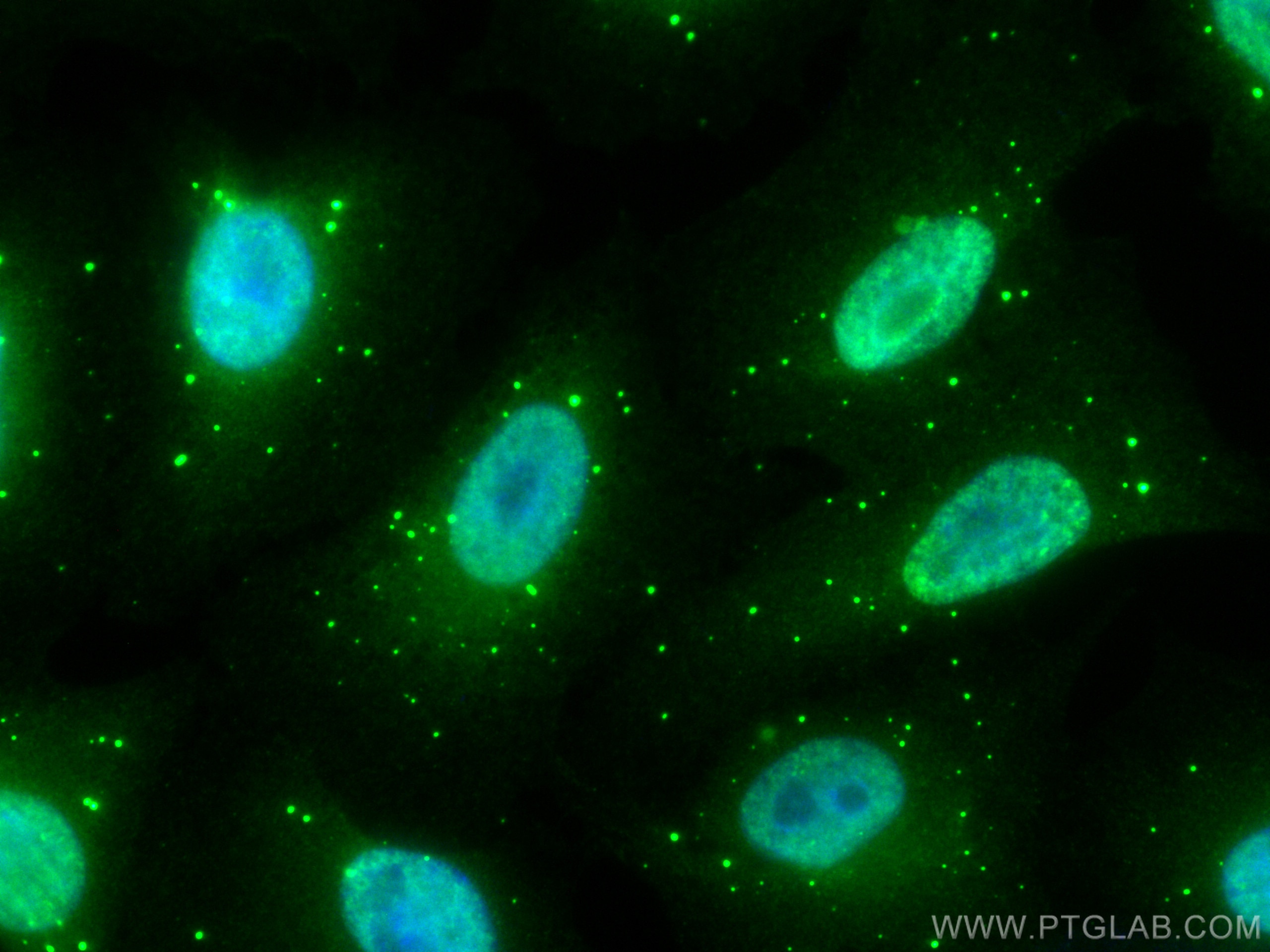 Immunofluorescence (IF) / fluorescent staining of A549 cells using CoraLite® Plus 488-conjugated IRS1 Polyclonal anti (CL488-17509)