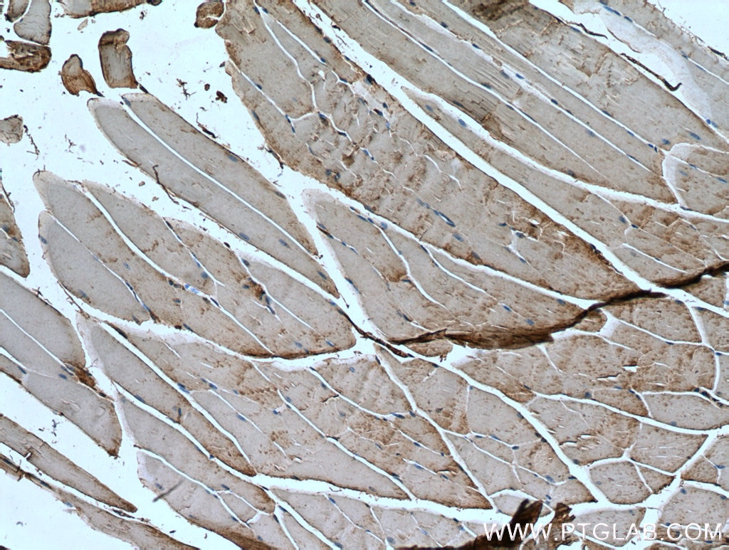 Immunohistochemistry (IHC) staining of mouse skeletal muscle tissue using IRS2 Polyclonal antibody (20702-1-AP)