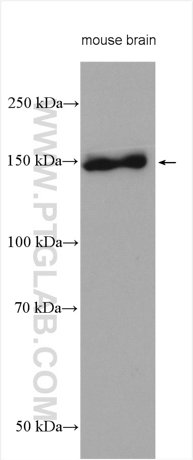 Western Blot (WB) analysis of various lysates using IRS2 Polyclonal antibody (20702-1-AP)