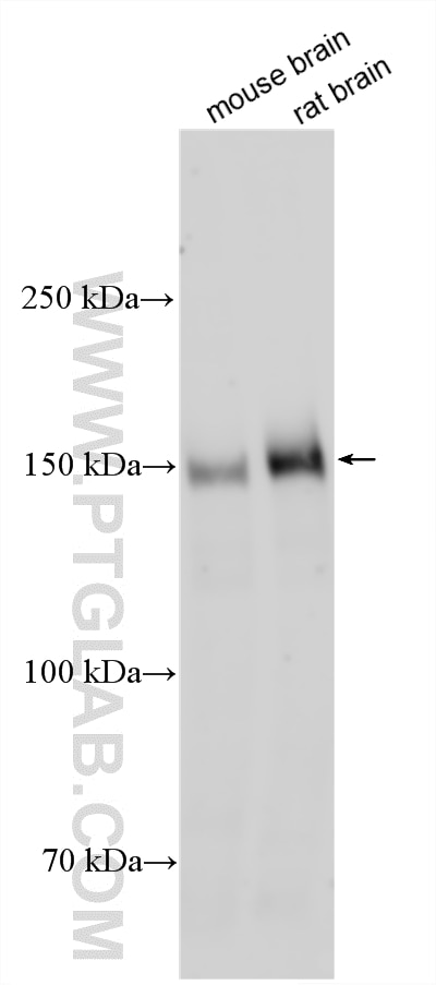 Western Blot (WB) analysis of various lysates using IRS2 Polyclonal antibody (20702-1-AP)