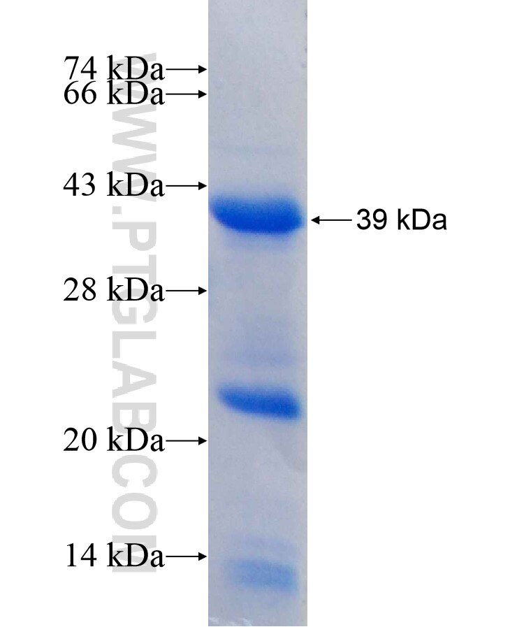 IRS4 fusion protein Ag17485 SDS-PAGE IRS4 fusion protein Ag17485 SDS-PAGE