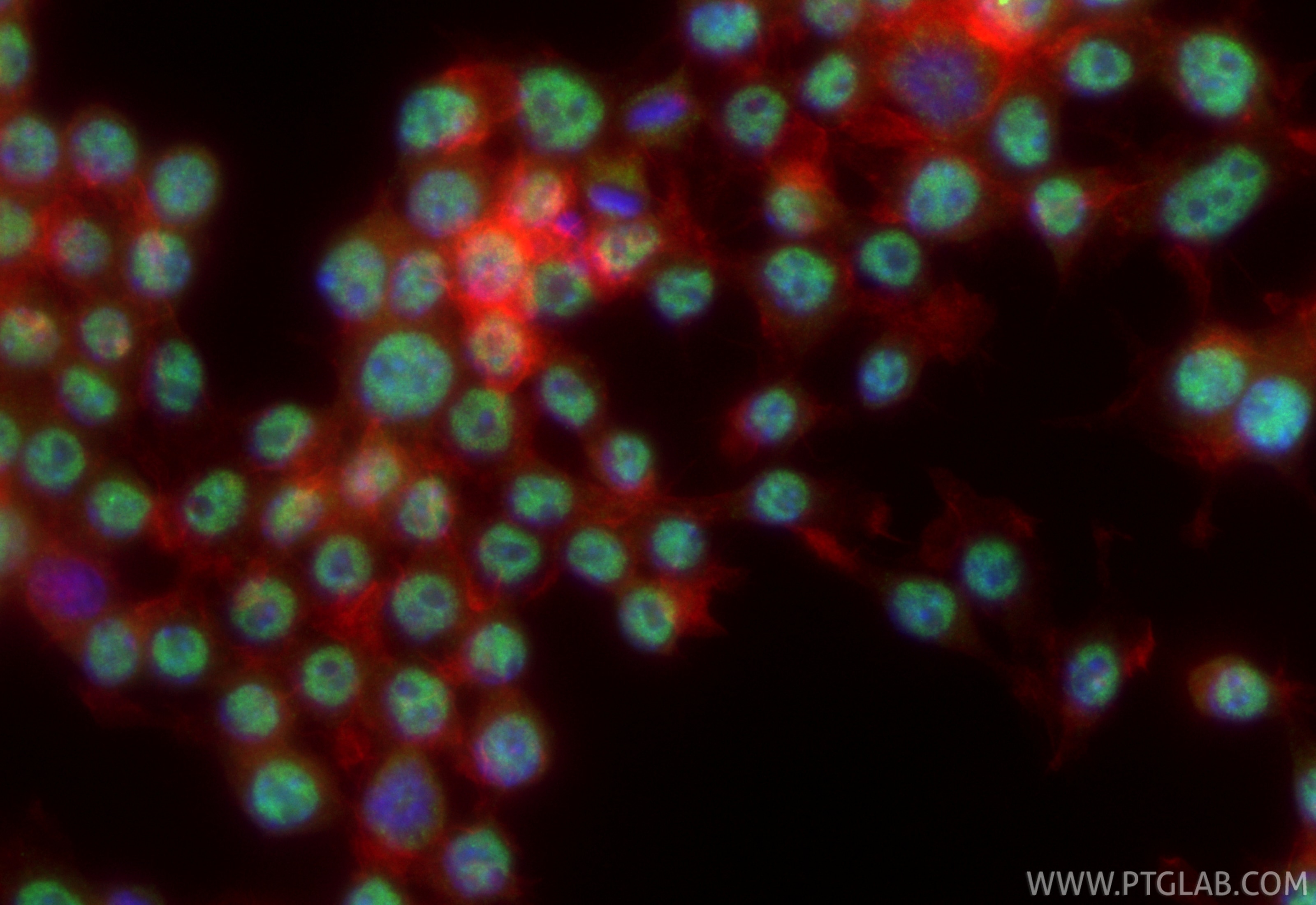 IF Staining of RAW 264.7 using 31699-1-AP Immunofluorescence (IF) / fluorescent staining of RAW 264.7 cells using IRX1 Polyclonal antibody (31699-1-AP)