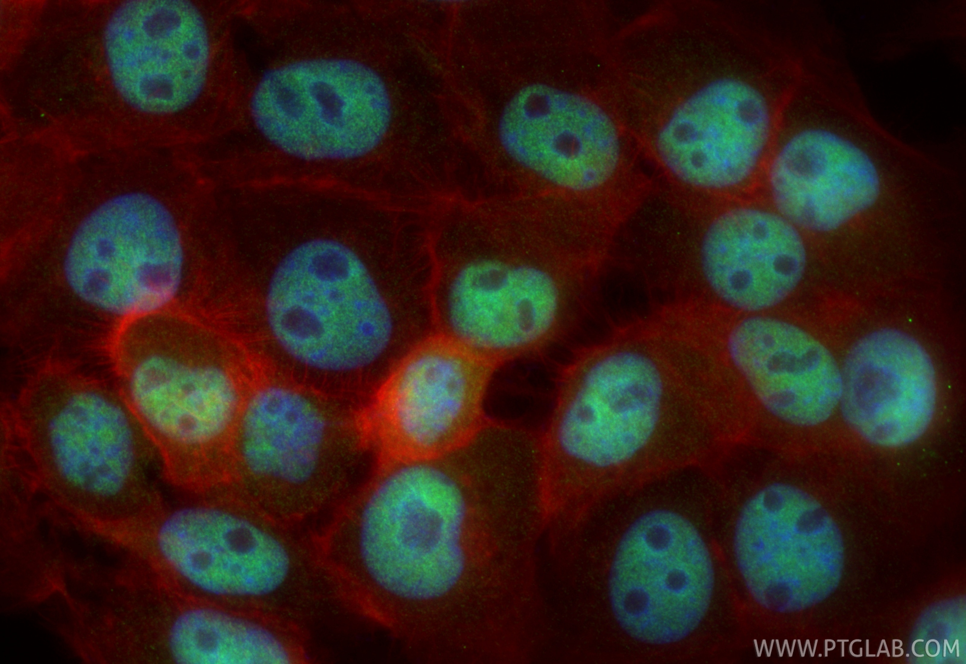 IF Staining of U-251 using 31699-1-AP Immunofluorescence (IF) / fluorescent staining of U-251 cells using IRX1 Polyclonal antibody (31699-1-AP)