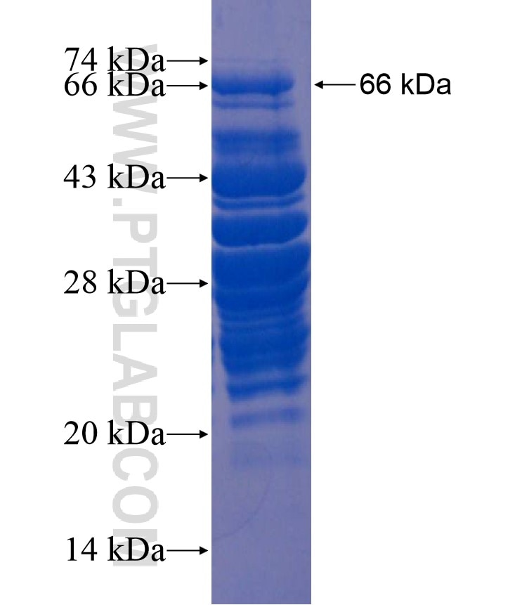 IRX4 fusion protein Ag18015 SDS-PAGE