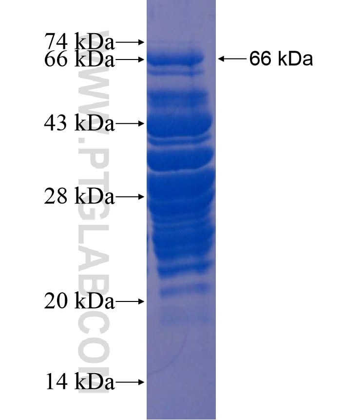 IRX4 fusion protein Ag18015 SDS-PAGE IRX4 fusion protein Ag18015 SDS-PAGE