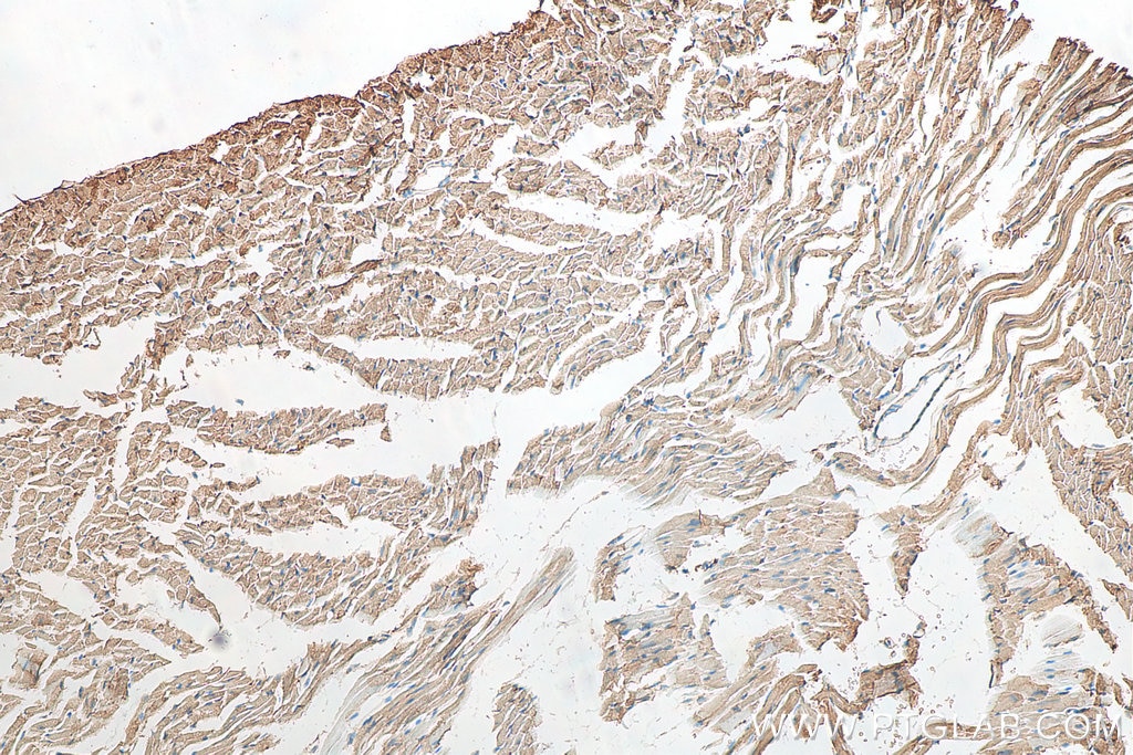Immunohistochemistry (IHC) staining of mouse heart tissue using IRX6 Polyclonal antibody (24440-1-AP)