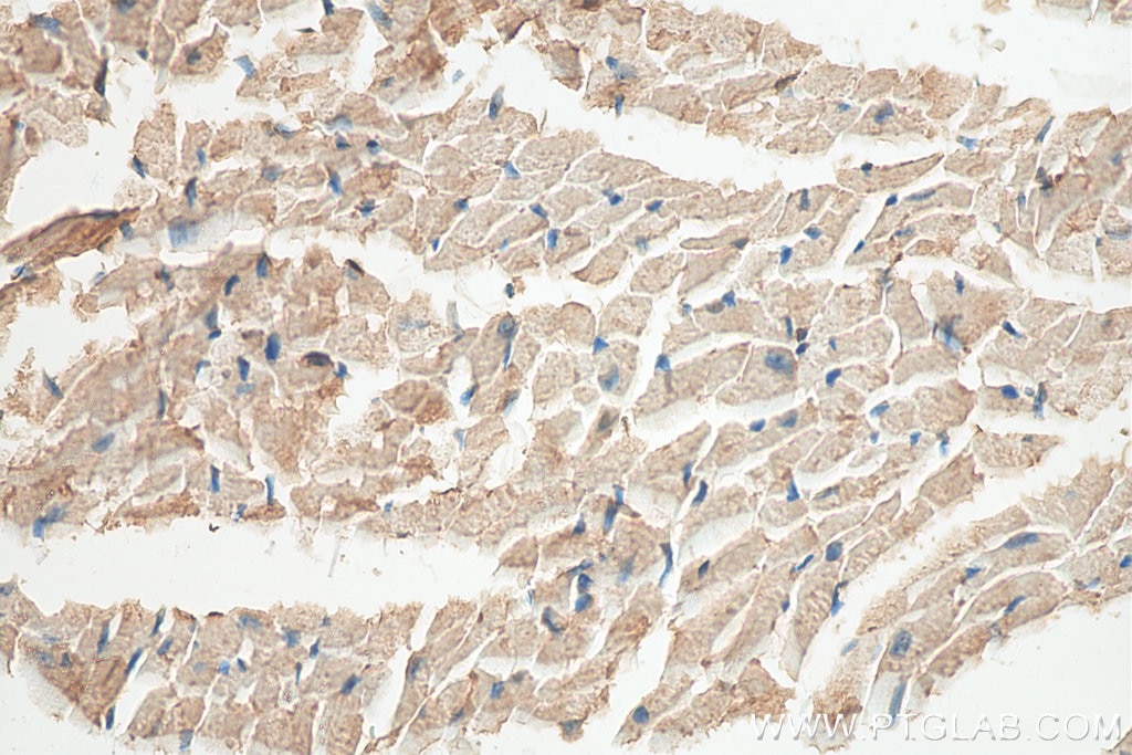 Immunohistochemistry (IHC) staining of mouse heart tissue using IRX6 Polyclonal antibody (24440-1-AP)