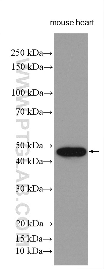 Western Blot (WB) analysis of various lysates using IRX6 Polyclonal antibody (24440-1-AP)