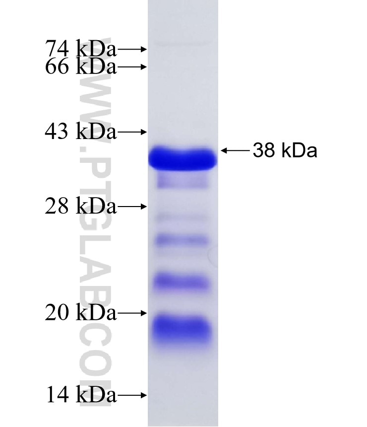 IRX6 fusion protein Ag19623 SDS-PAGE