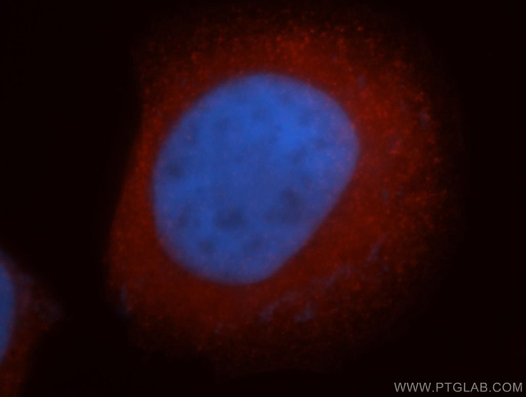 IF Staining of MCF-7 using 14812-1-AP