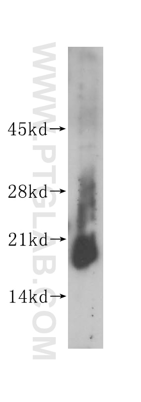 Western Blot (WB) analysis of COLO 320 cells using ISCU Polyclonal antibody (14812-1-AP)